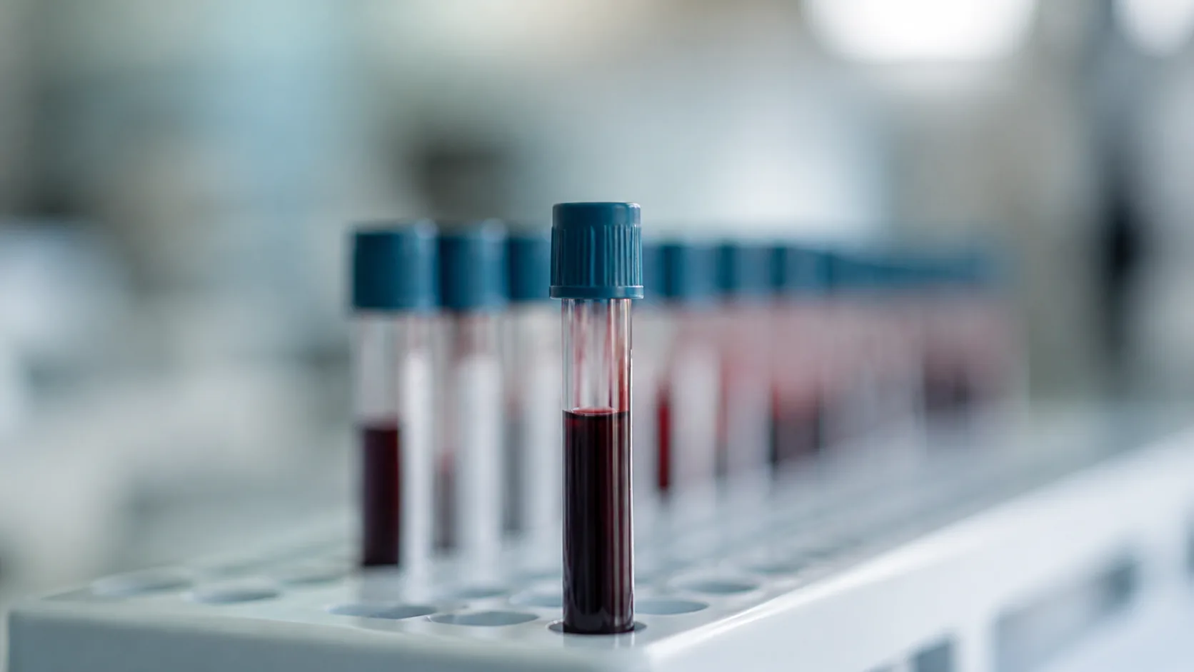 Single capped blood tube standing in sharp focus at the front of a long blurred laboratory rack, cold overhead light