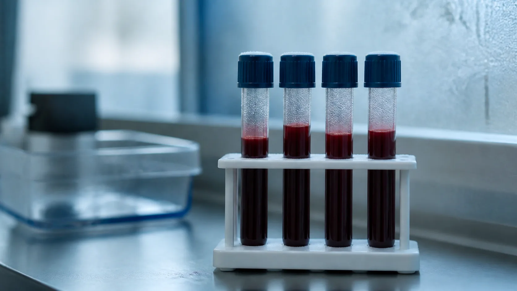 Four capped blood collection tubes standing in a small white rack on a laboratory bench, condensation on the glass