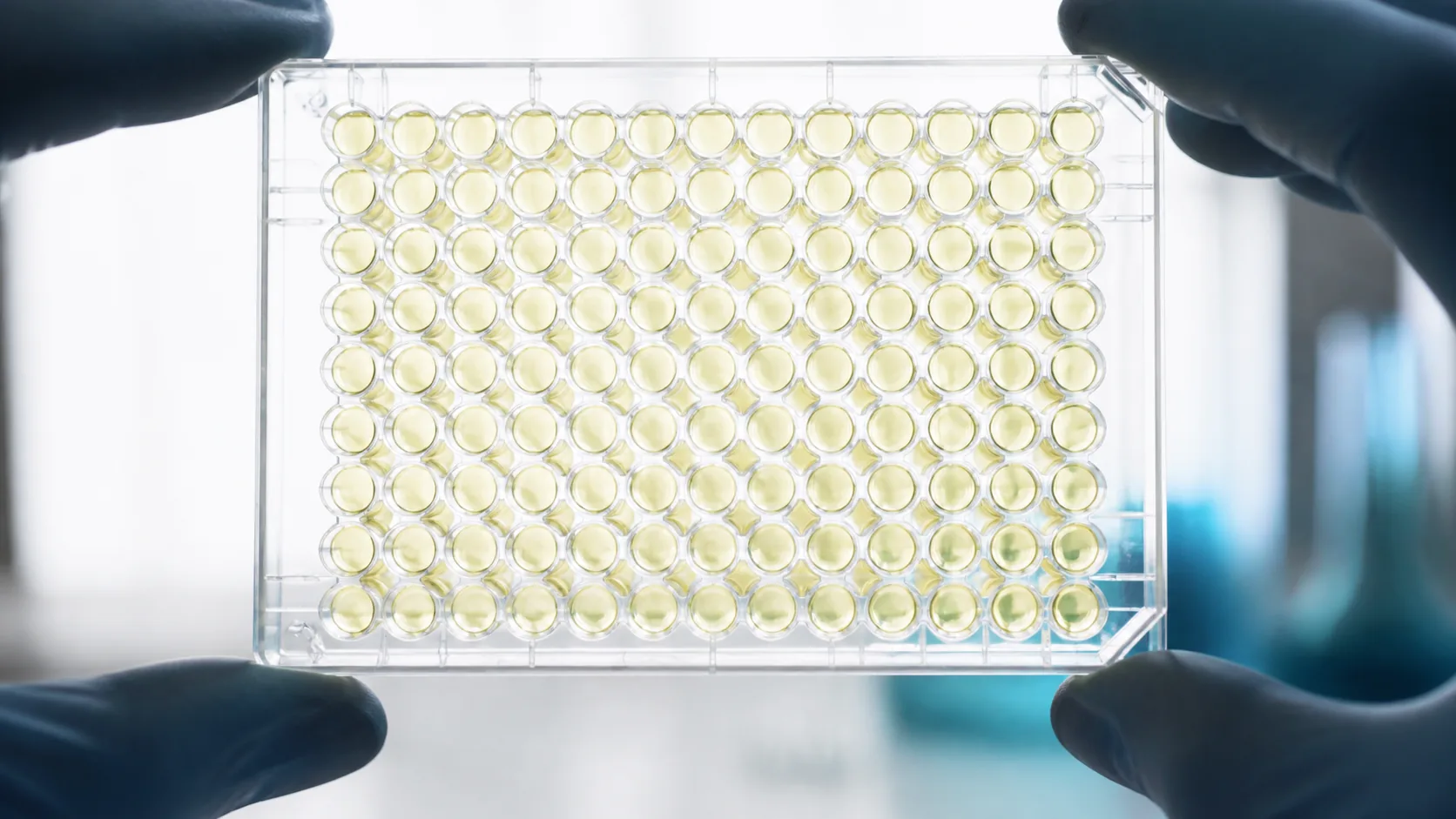 Clear ninety-six-well ELISA microplate held up against a softbox so the wells glow pale yellow