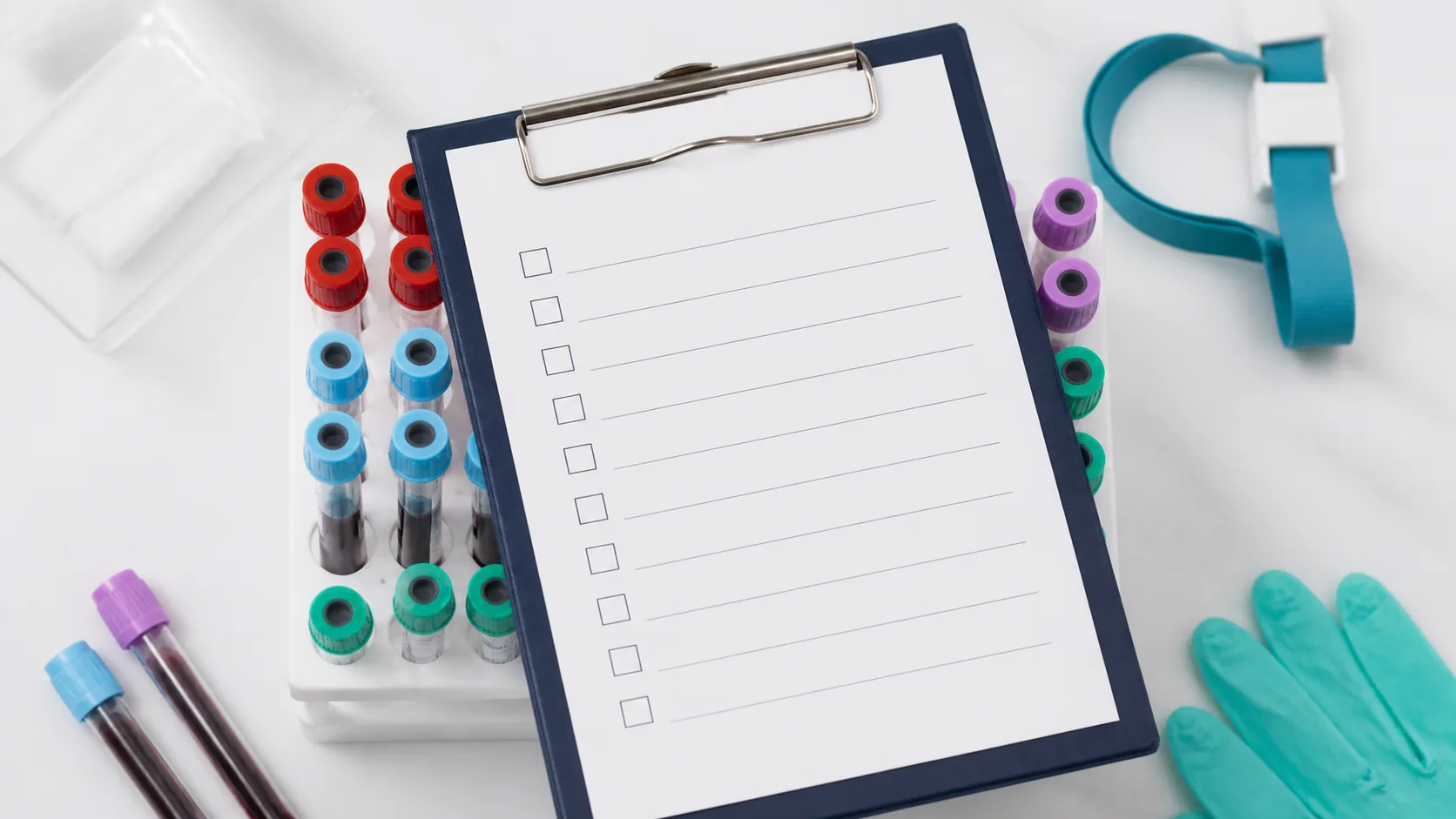 Doctor's clipboard with a blank checklist lying across a laboratory rack of assorted blood tubes on a white desk, top-down